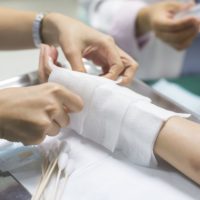 Nurse dressing wound for patients hand with burn injury